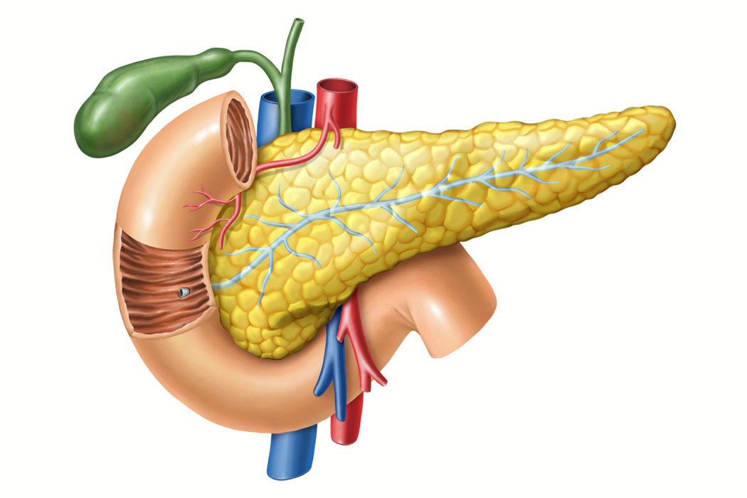 Κύστη παγκρέατος